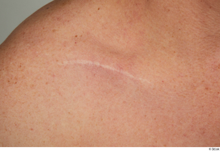 Steve Q chest scar skin 0001.jpg